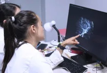 Trabajo multidisciplinario permitió tratamiento avanzado para ACV severo en paciente curicano-1