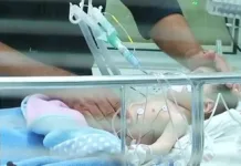 Bebe De Ocho Meses Permanece Hospitalizado Tras Intoxicacion Con Cocaina Pdi Y Fiscalia Investigan Presunto Abandono