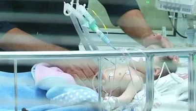 Bebe De Ocho Meses Permanece Hospitalizado Tras Intoxicacion Con Cocaina Pdi Y Fiscalia Investigan Presunto Abandono